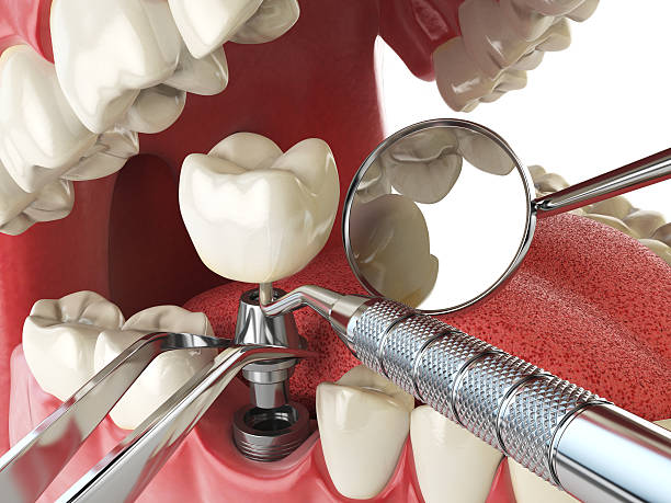 Best Emergency Care for Gum Disease in Pineville, NC